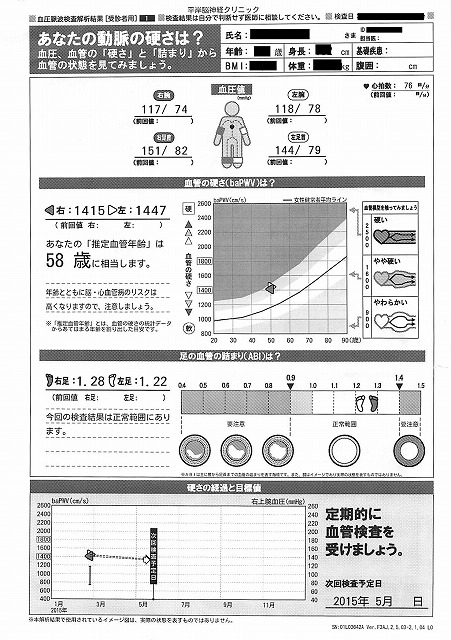 s-PWV1